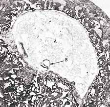 Gambar 3. Pada fotomikrograf ini kita dapat melihat bergantungnya embrio (panah B) pada fase 'alaqah (sekitar umur 15 hari) di dalam rahim sang ibu. Ukuran sebenarnya dari embrio ini adalah sekitar 0.6 mm.