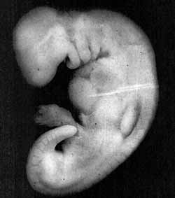 The Quran on Human Embryonic Development: